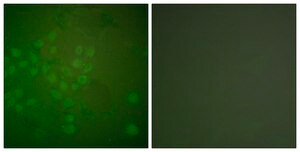 Anti-RAD17 antibody produced in rabbit affinity isolated antibody