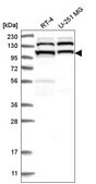 Anti-EXOC4 antibody produced in rabbit Prestige Antibodies&#174; Powered by Atlas Antibodies, affinity isolated antibody
