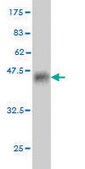 ANTI-RARA antibody produced in mouse clone 1C10, purified immunoglobulin, buffered aqueous solution