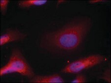 Anti-phospho-SRC (pTyr529) antibody produced in rabbit affinity isolated antibody