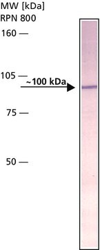 Anti-Amyloid Precursor Protein, N-Terminal antibody produced in rabbit IgG fraction of antiserum, buffered aqueous solution