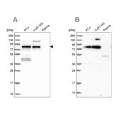 Anti-TNIP1 antibody produced in rabbit Prestige Antibodies® Powered by Atlas Antibodies, affinity isolated antibody, buffered aqueous glycerol solution