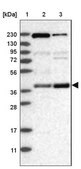 Anti-S100PBP antibody produced in rabbit Prestige Antibodies&#174; Powered by Atlas Antibodies, affinity isolated antibody, buffered aqueous glycerol solution