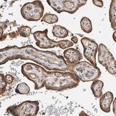 Anti-LZTS1 antibody produced in rabbit Prestige Antibodies® Powered by Atlas Antibodies, affinity isolated antibody, buffered aqueous glycerol solution