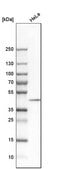 Anti-DNAJB11 antibody produced in rabbit Ab1, Prestige Antibodies&#174; Powered by Atlas Antibodies, affinity isolated antibody, buffered aqueous glycerol solution