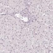 Anti-PLA2G4F antibody produced in rabbit Prestige Antibodies® Powered by Atlas Antibodies, affinity isolated antibody, buffered aqueous glycerol solution