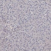 Anti-ALPK1 antibody produced in rabbit Prestige Antibodies&#174; Powered by Atlas Antibodies, affinity isolated antibody, buffered aqueous glycerol solution, ab1