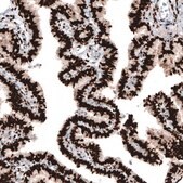 Monoclonal Anti-PGR antibody produced in mouse Prestige Antibodies® Powered by Atlas Antibodies, clone CL8721, purified immunoglobulin, buffered aqueous glycerol solution