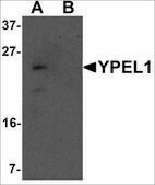 Anti-YPEL1 antibody produced in rabbit affinity isolated antibody