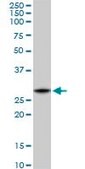 Monoclonal Anti-C1QTNF1 antibody produced in mouse clone 4A10, purified immunoglobulin, buffered aqueous solution
