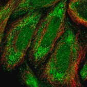 Anti-ZNF684 antibody produced in rabbit Prestige Antibodies® Powered by Atlas Antibodies, affinity isolated antibody, buffered aqueous glycerol solution