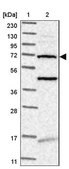 Anti-TMEM87B antibody produced in rabbit Prestige Antibodies® Powered by Atlas Antibodies, affinity isolated antibody, buffered aqueous glycerol solution
