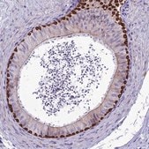 Anti-SPTLC3 antibody produced in rabbit Prestige Antibodies&#174; Powered by Atlas Antibodies, affinity isolated antibody, buffered aqueous glycerol solution