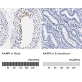 Anti-AKAP4 antibody produced in rabbit Prestige Antibodies® Powered by Atlas Antibodies, affinity isolated antibody, buffered aqueous glycerol solution