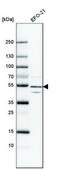Anti-MACROD2 antibody produced in rabbit Prestige Antibodies® Powered by Atlas Antibodies, affinity isolated antibody, buffered aqueous glycerol solution