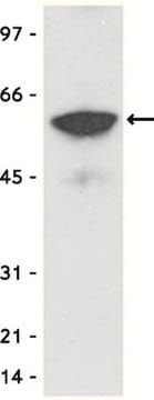 Anti-Myc Tag Antibody, clone 4A6, agarose conjugate clone 4A6, Upstate&#174;, from mouse