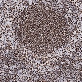 Anti-MATR3 antibody produced in rabbit Prestige Antibodies&#174; Powered by Atlas Antibodies, affinity isolated antibody, buffered aqueous glycerol solution