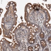 Anti-ERAL1 antibody produced in rabbit Prestige Antibodies&#174; Powered by Atlas Antibodies, affinity isolated antibody, buffered aqueous glycerol solution, Ab2