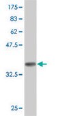 Monoclonal Anti-GSTZ1 antibody produced in mouse clone 1G12, purified immunoglobulin, buffered aqueous solution