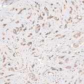 Anti-NCR3LG1 antibody produced in rabbit Prestige Antibodies® Powered by Atlas Antibodies, affinity isolated antibody, buffered aqueous glycerol solution