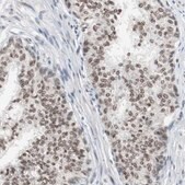 Anti-LIG3 antibody produced in rabbit Prestige Antibodies&#174; Powered by Atlas Antibodies, affinity isolated antibody, buffered aqueous glycerol solution