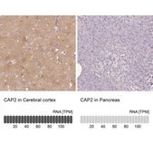 Anti-CAP2 antibody produced in rabbit Prestige Antibodies® Powered by Atlas Antibodies, affinity isolated antibody, buffered aqueous glycerol solution
