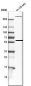 Anti-ENG antibody produced in rabbit Prestige Antibodies&#174; Powered by Atlas Antibodies, affinity isolated antibody, buffered aqueous glycerol solution