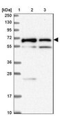 Anti-TMEM200C antibody produced in rabbit Prestige Antibodies&#174; Powered by Atlas Antibodies, affinity isolated antibody, buffered aqueous glycerol solution