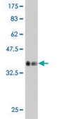 Monoclonal Anti-LMO1 antibody produced in mouse clone 4F7, purified immunoglobulin, buffered aqueous solution