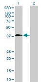 Anti-ZNF557 antibody produced in mouse purified immunoglobulin, buffered aqueous solution