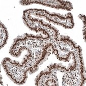 Monoclonal Anti-NFKB2 antibody produced in mouse Prestige Antibodies&#174; Powered by Atlas Antibodies, clone CL8266, purified immunoglobulin, buffered aqueous glycerol solution