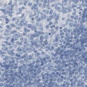 Anti-OPN1SW antibody produced in rabbit Prestige Antibodies&#174; Powered by Atlas Antibodies, affinity isolated antibody