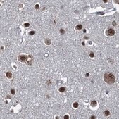 Anti-ZC3H18 antibody produced in rabbit Prestige Antibodies&#174; Powered by Atlas Antibodies, affinity isolated antibody, buffered aqueous glycerol solution