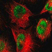 Anti-ZNF222 antibody produced in rabbit Prestige Antibodies® Powered by Atlas Antibodies, affinity isolated antibody, buffered aqueous glycerol solution
