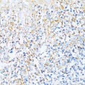 Anti-NDUFA5 antibody produced in rabbit