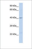 Anti-GJA1 antibody produced in rabbit affinity isolated antibody