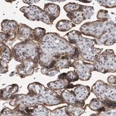 Anti-EVI5 antibody produced in rabbit Prestige Antibodies&#174; Powered by Atlas Antibodies, affinity isolated antibody, buffered aqueous glycerol solution