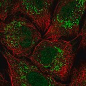 Anti-KCNH3 antibody produced in rabbit Prestige Antibodies&#174; Powered by Atlas Antibodies, affinity isolated antibody, buffered aqueous glycerol solution
