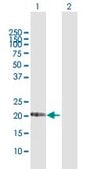 Anti-DHRS11 antibody produced in rabbit purified immunoglobulin, buffered aqueous solution