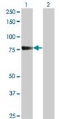Monoclonal Anti-CDH6 antibody produced in mouse clone 2F2, purified immunoglobulin, buffered aqueous solution