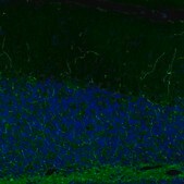 Monoclonal Anti-SLC6A2 antibody produced in mouse Prestige Antibodies® Powered by Atlas Antibodies, clone CL3063, purified immunoglobulin, buffered aqueous glycerol solution