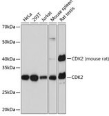 [KO Validated]Anti-CDK2 Antibody, clone 10E0N5, Rabbit Monoclonal