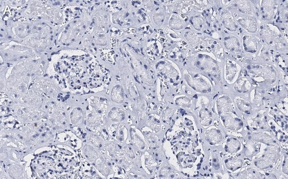 Anti-CD34 Antibody, clone 5C15 , ZooMAb&#174; Rabbit Monoclonal recombinant, expressed in HEK 293 cells