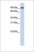 Anti-NR3C1 antibody produced in rabbit affinity isolated antibody