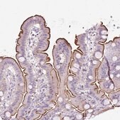 Anti-PLS1 antibody produced in rabbit Prestige Antibodies&#174; Powered by Atlas Antibodies, affinity isolated antibody, buffered aqueous glycerol solution