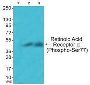 Anti-Retinoic Acid Receptor A (Phospho-SER77) affinity isolated antibody