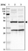 Anti-AVEN antibody produced in rabbit Prestige Antibodies&#174; Powered by Atlas Antibodies, affinity isolated antibody, buffered aqueous glycerol solution
