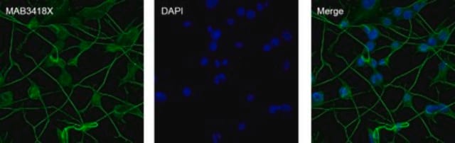 Anti-MAP2 Antibody, Alexa Fluor&#8482; 488 conjugated clone AP20, Chemicon&#174;, from mouse
