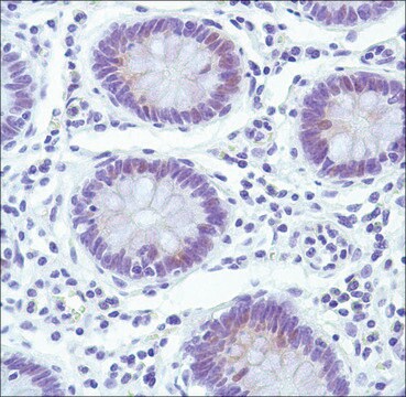 Anti-Cyclin E1 antibody, Rabbit monoclonal clone SP146, recombinant, expressed in proprietary host, affinity isolated antibody