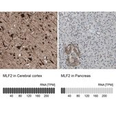 Anti-MLF2 antibody produced in rabbit Ab2, Prestige Antibodies® Powered by Atlas Antibodies, affinity isolated antibody, buffered aqueous glycerol solution